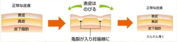 �D�P�����ł���d�g�݉摜